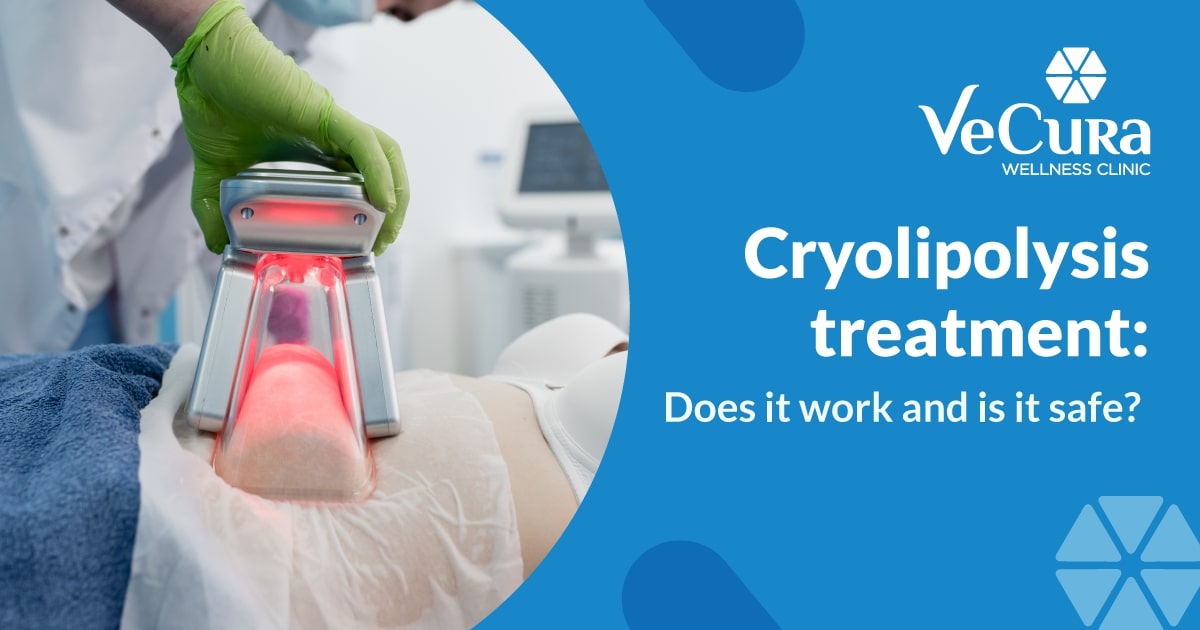 Cryolipolysis treatment: Does it work and is it safe?